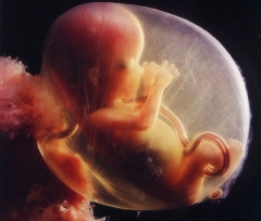 avortement-1440619389_137234_1000x667x0.jpg