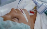 coma_1615608c.jpg
